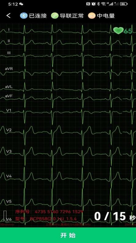 Aplicativo de rede de ECG