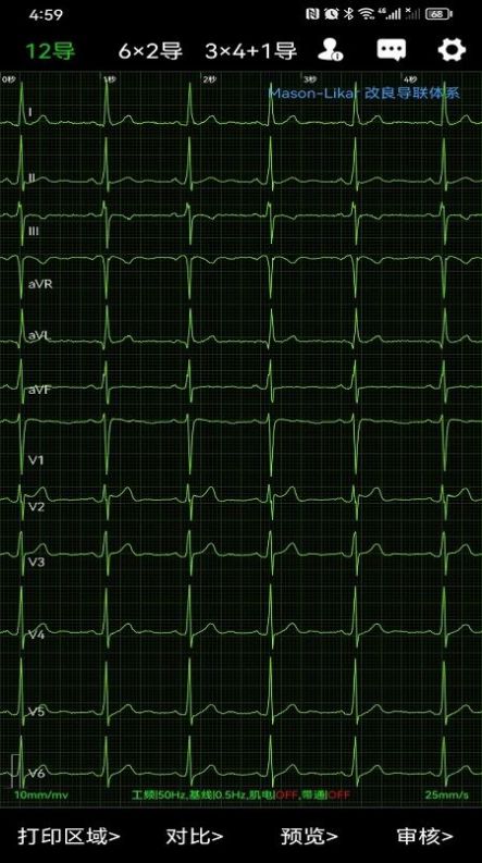 Aplicativo de rede de ECG