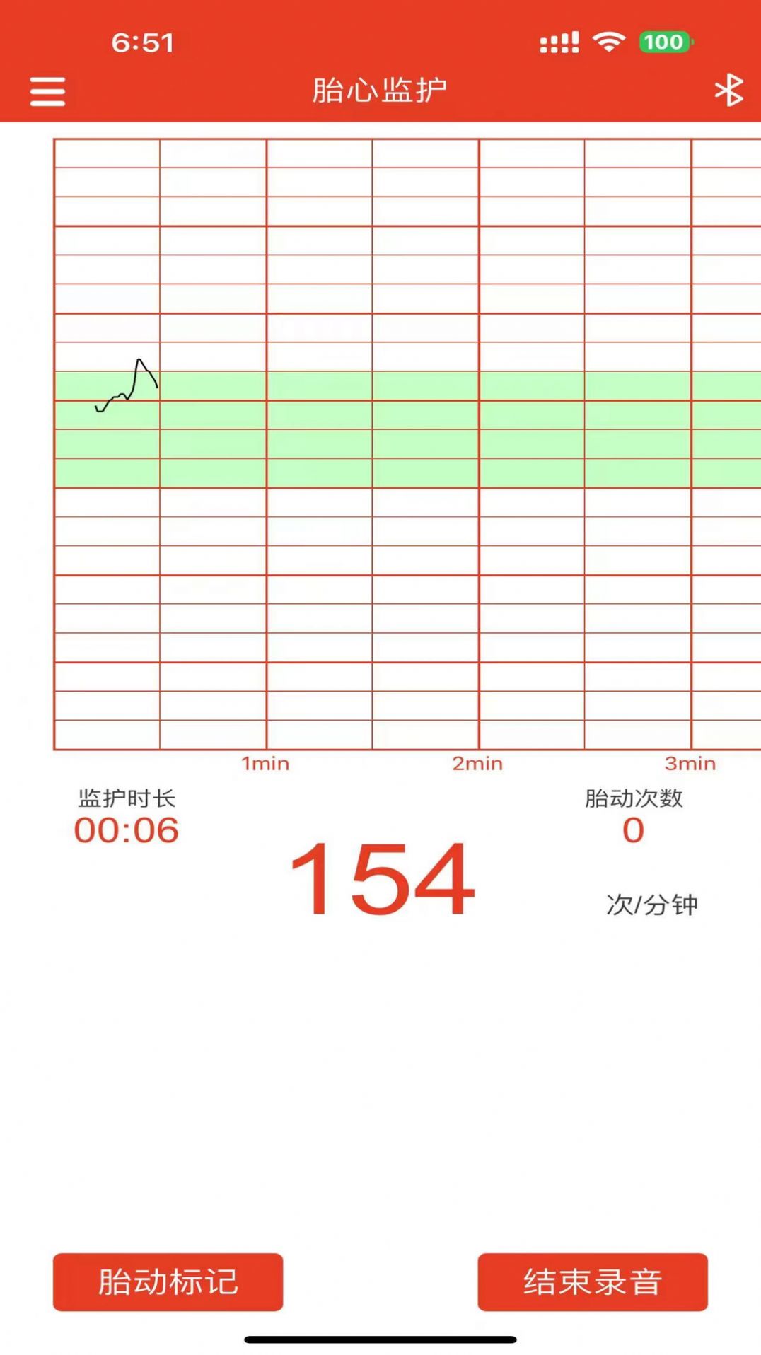 Clique com o botão esquerdo no software do monitor de frequência cardíaca fetal