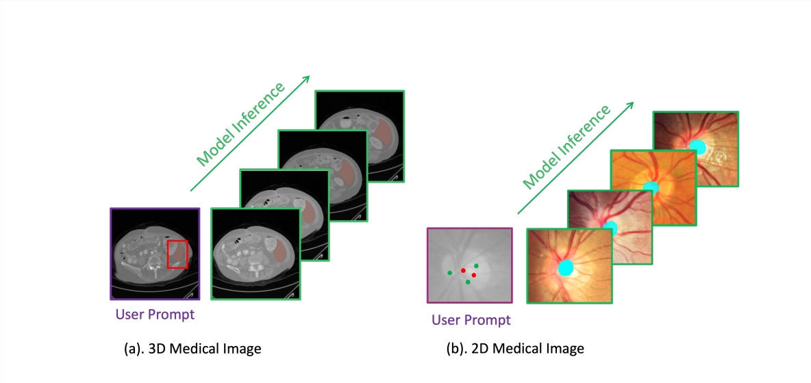 Une nouvelle ère de segmentation des images médicales ! MedSAM-2 permet aux machines de lire les secrets du corps