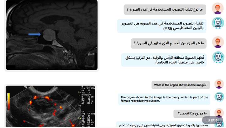 Das künstliche Intelligenzmodell BiMediX2 kann medizinische Bilder, insbesondere für Arabisch, analysieren und übersetzen.