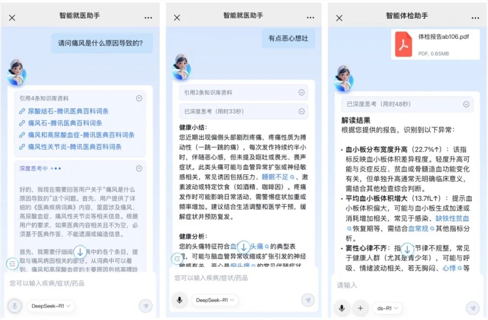 Tencent Health Access Deepseek+Tencent Hunyuan Dual Model Upgrade Medical Experience -AI記事