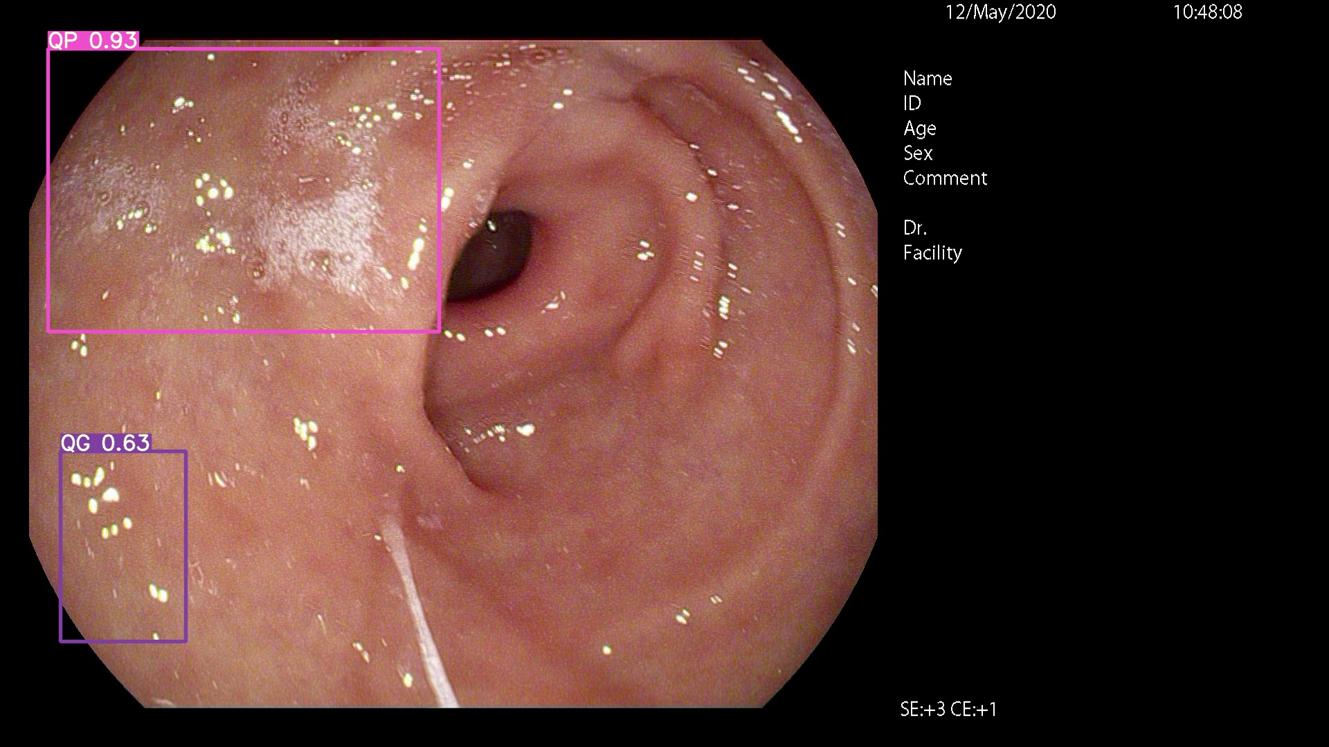Screenshot 2020-04-01 bei 11 44 26 Uhr
